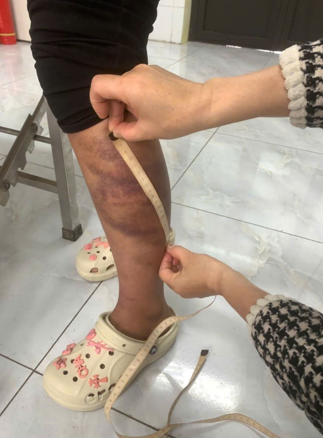 Nóng!! Tân Tiến Đối tượng 🤛 vợ đang b..ầ..u và con nhỏ daman, cứ trái ý là 💪🤛